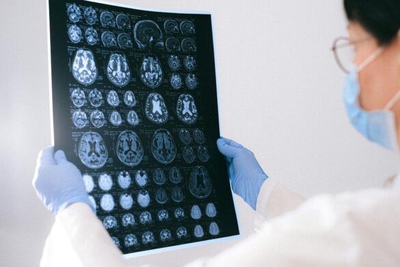 FDA Approves Eli Lilly's New Alzheimer's Drug for Early Disease Symptoms